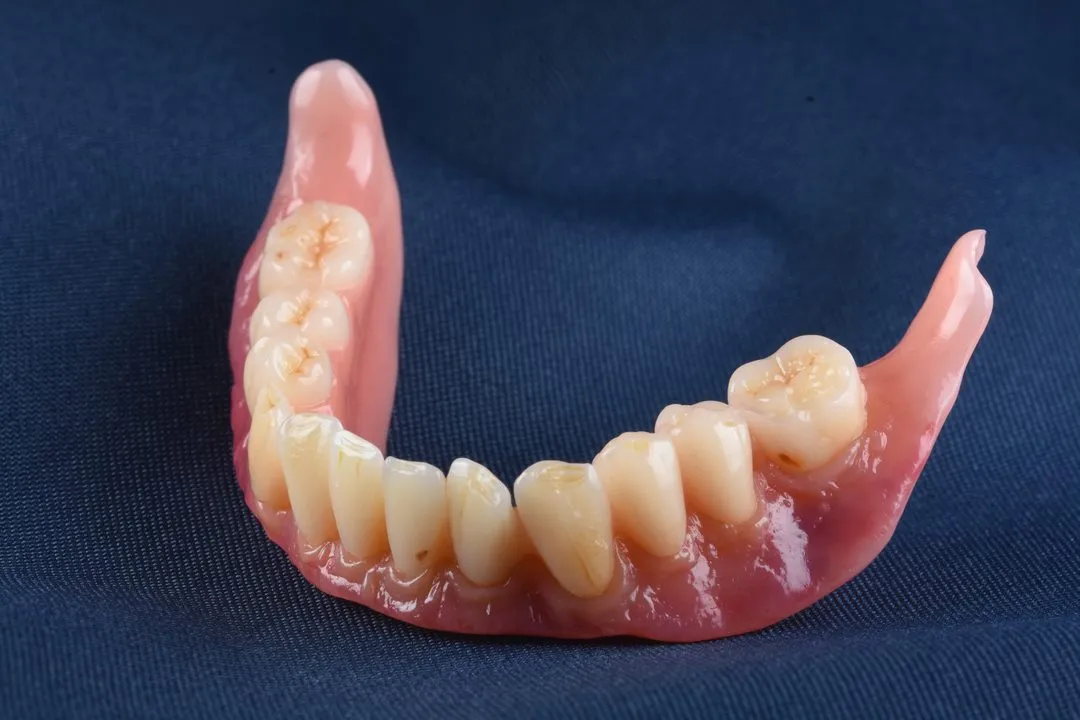 How Do Dental Labs Make Partial Dentures?