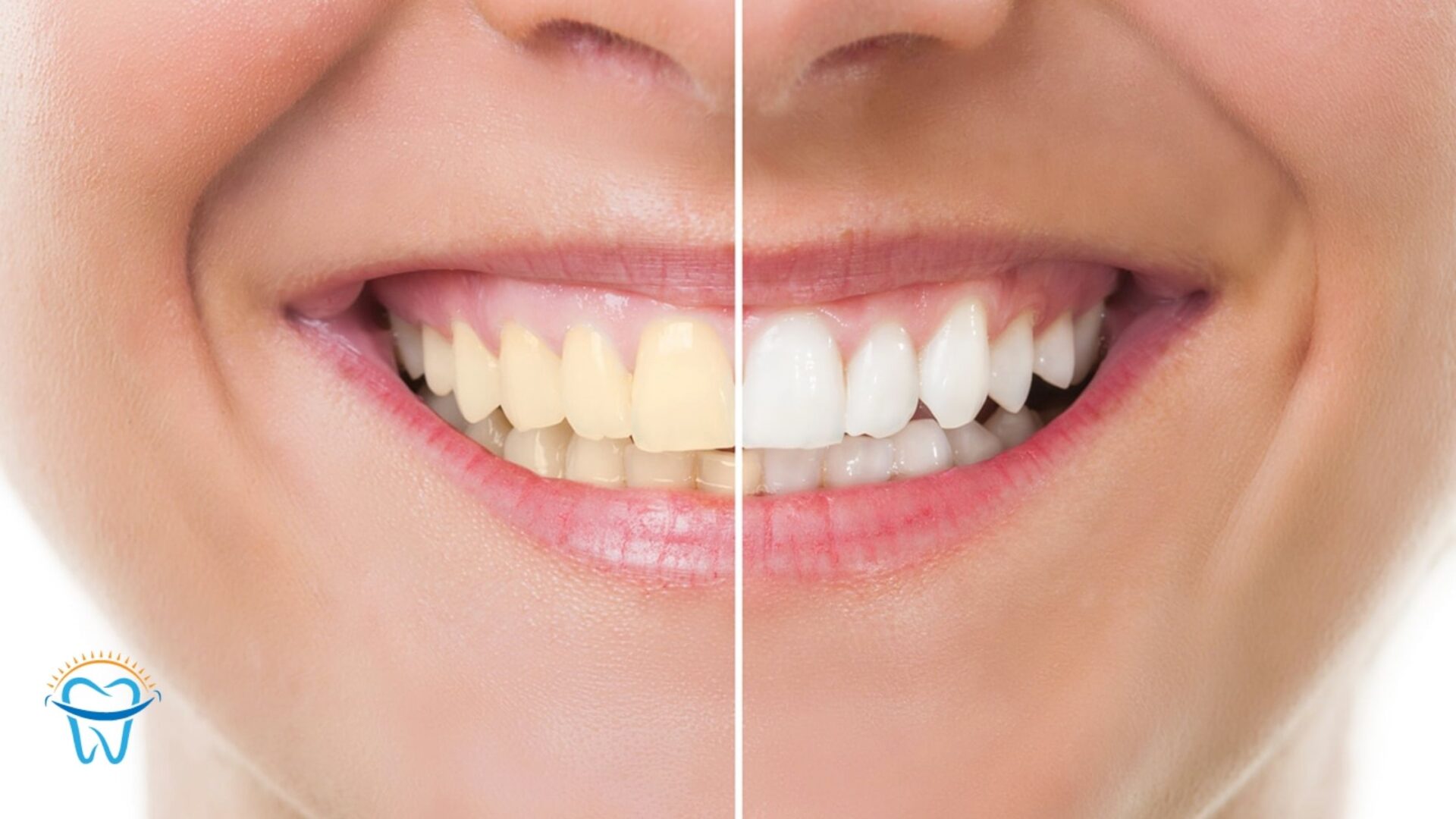 Cosmetic Dentistry for Busy People: Quick Fixes for a Beautiful Smile