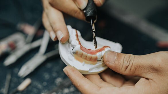 The Evolution of Denture Materials
