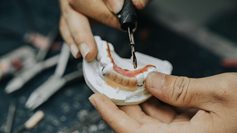 The Evolution of Denture Materials