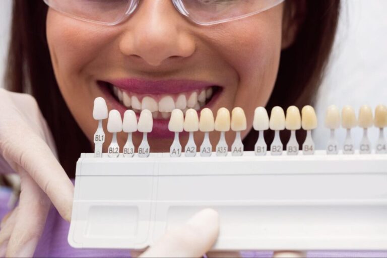 What Are Dental Crowns and When Do You Need One?